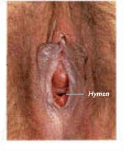 The Hymen